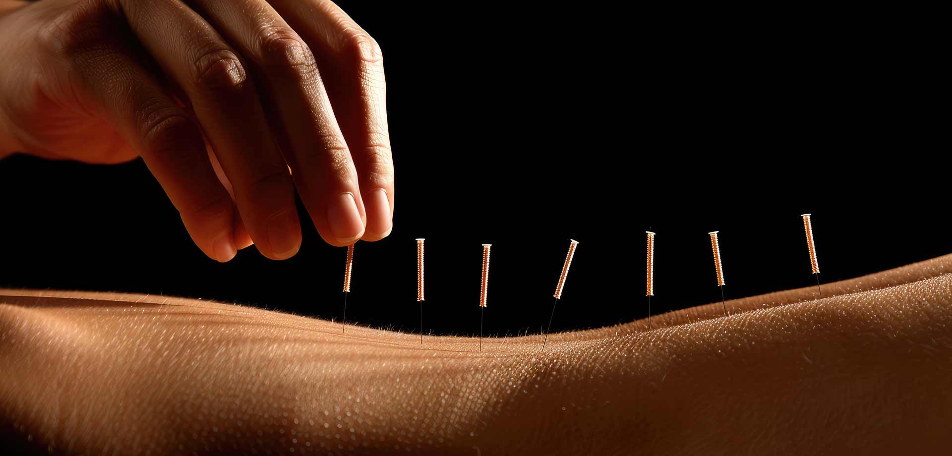 CEMETC Madrid, acupuntura