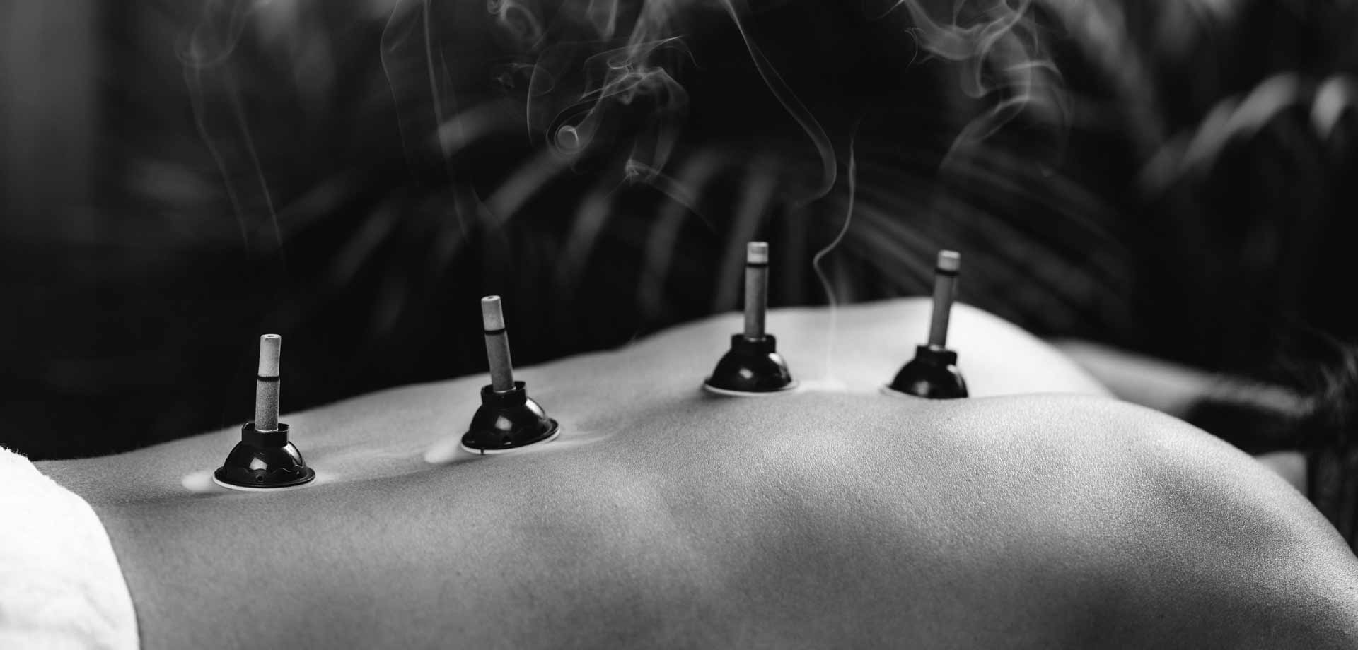 CEMETC Madrid, moxibustión